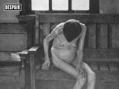 Old woman left to live day after day sitting naked without diversion or exercise.