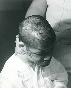 Injured child