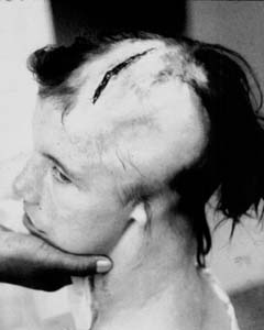 Injured child