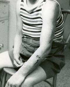 Injured child