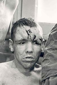 Injured child