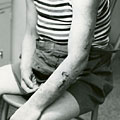 Injured child