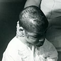 Injured child