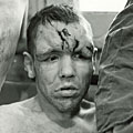 Injured resident